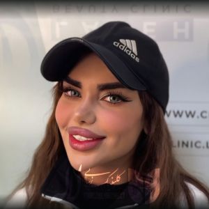 بهترین سن برای کاشت ابرو 