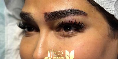 کاشت ابرو در زمان بارداری